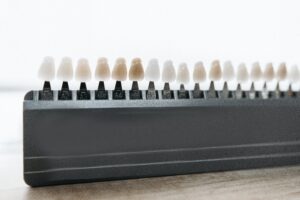 Shade selection of different shades of dental veneers