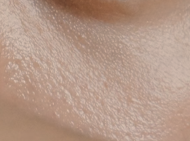 sebum oily skin close-up