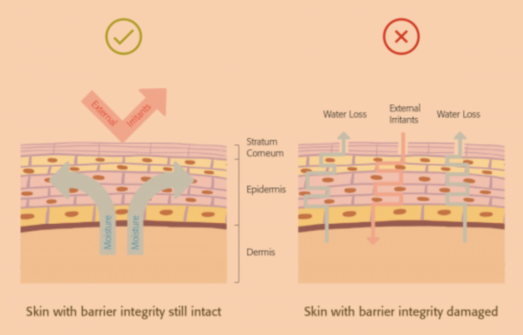 diagram showing healthy versus unhealthy skin barrier due to lack of TEWL from moisturiser use